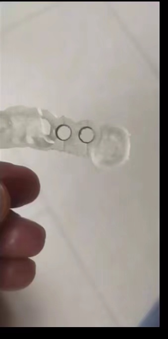 Resina dental impressora 3d gu - 3D Printing Uv Resin avaliação e preço